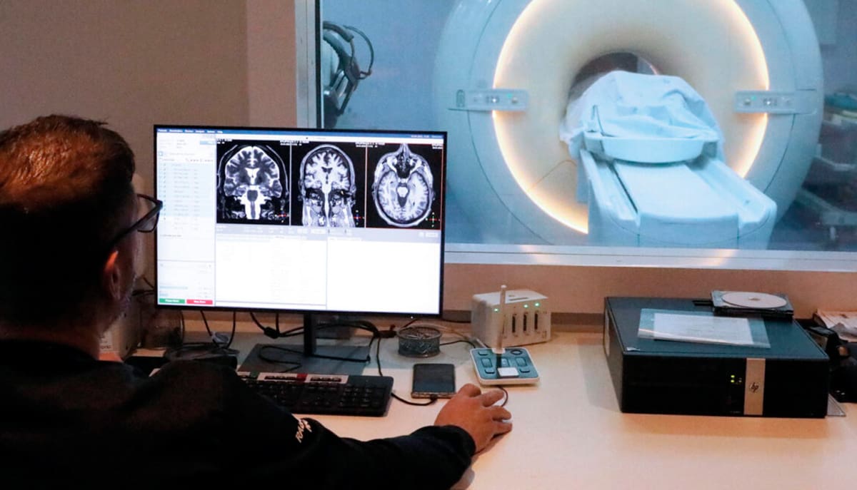 Pesquisas brasileiras avançam no desenvolvimento de tratamentos para epilepsia