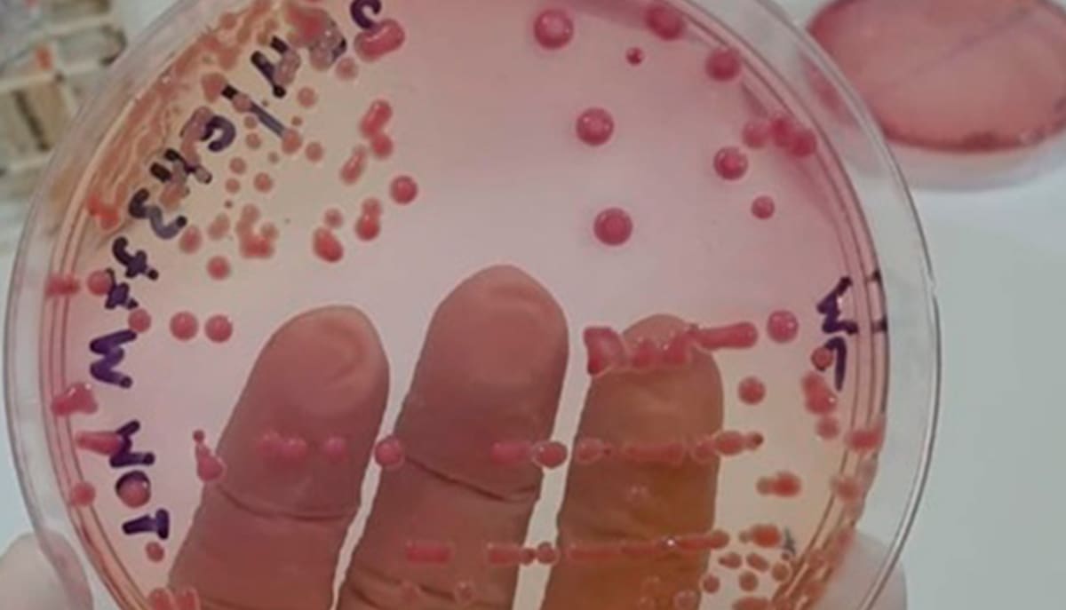 Superbactérias apresentam resistência preocupante a antibióticos em hospitais públicos de Rondônia
