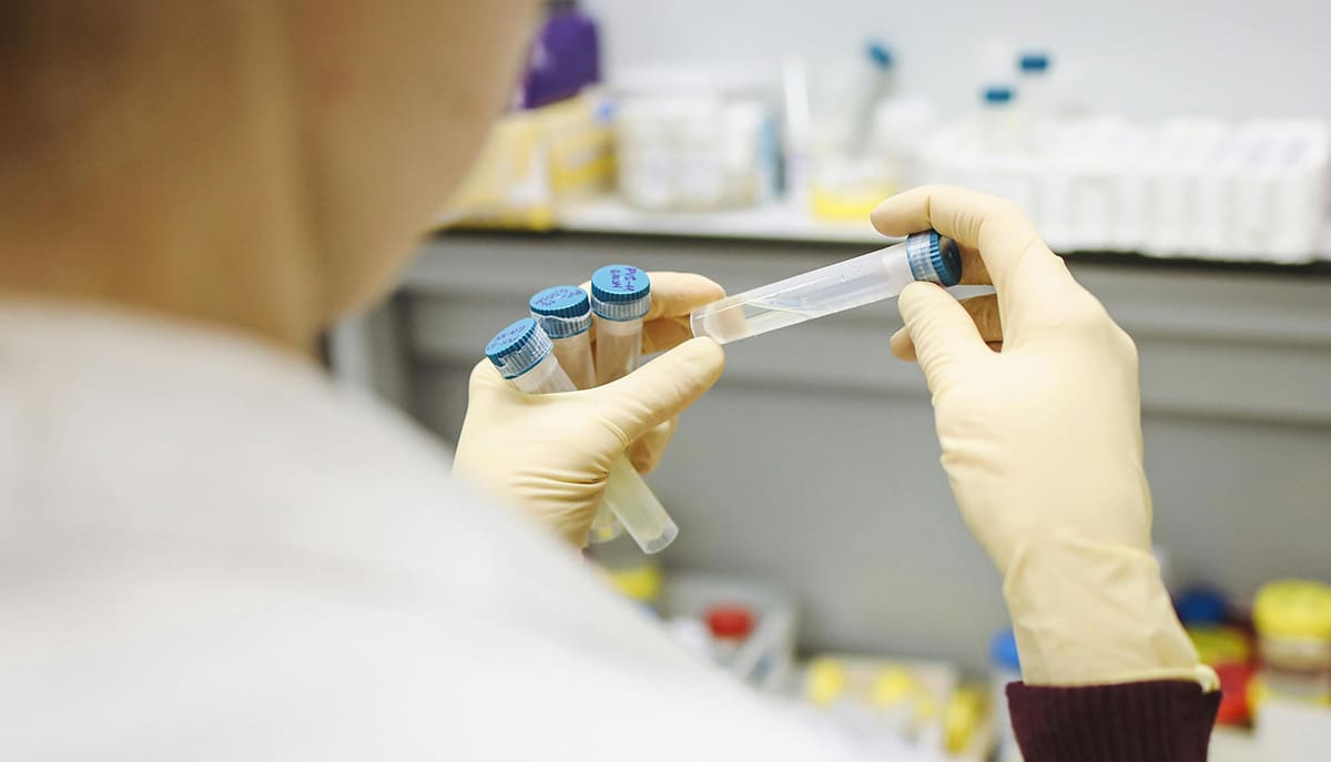 O SUS amplia a prevenção das hepatites virais com testagem rápida em todo o Brasil