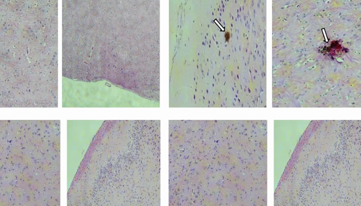 Equipe da USP desenvolve uma vacina contra zika com resultados superiores em testes com roedores