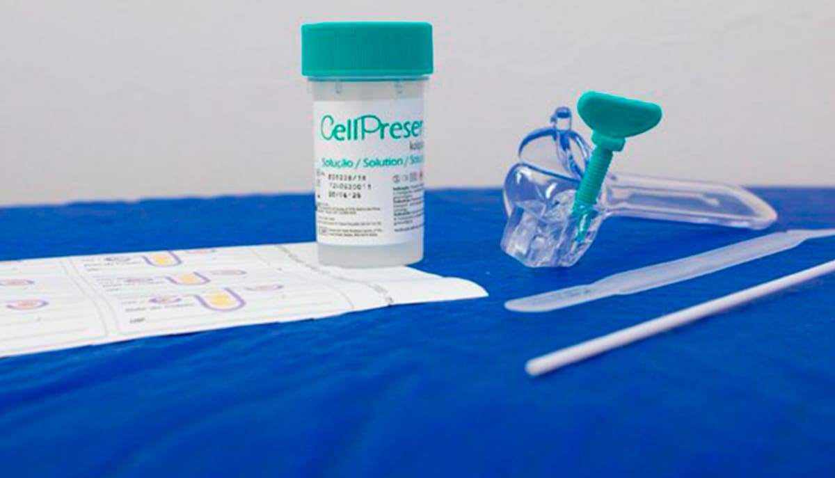 O teste DNA-HPV identifica o vírus antes do surgimento de lesões no colo do útero